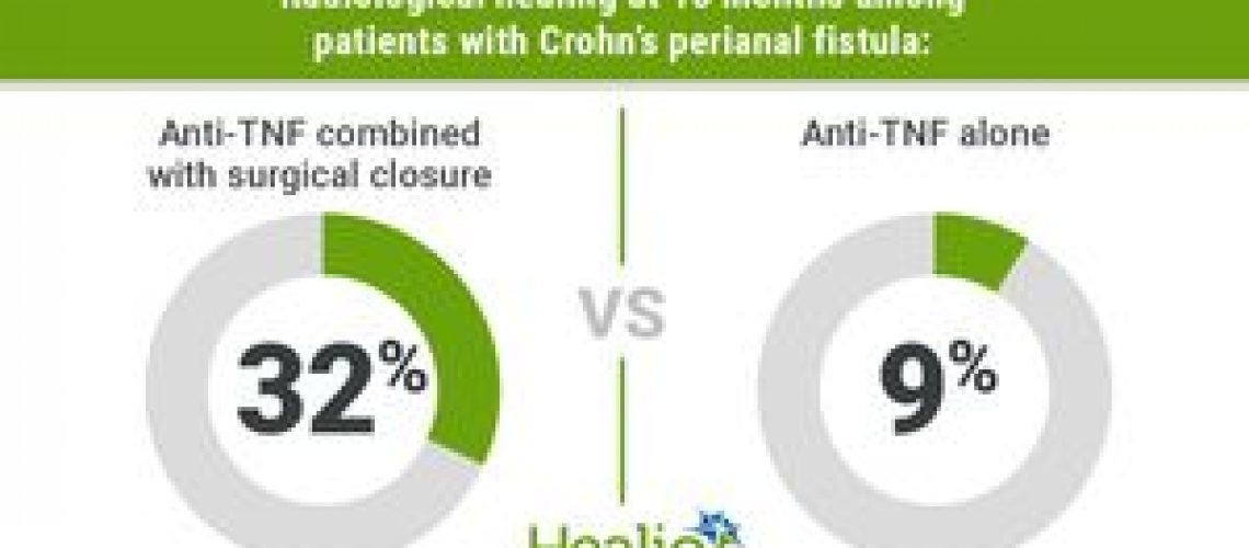 Anti-TNF, surgical closure induces long-term healing in Crohn’s fistulas